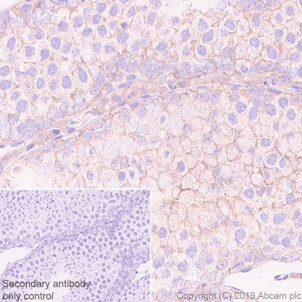 Immunohistochemistry (Formalin/PFA-fixed paraffin-embedded sections) - Anti-GBA2 antibody [4A12] (AB252831), expandable thumbnail