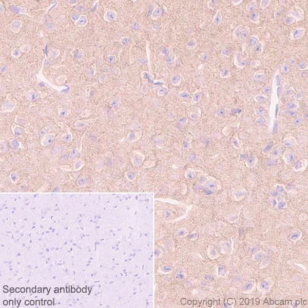 Immunohistochemistry (Formalin/PFA-fixed paraffin-embedded sections) - Anti-GBA2 antibody [4A12] - BSA and Azide free (AB255787)