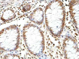 Immunohistochemistry (Formalin/PFA-fixed paraffin-embedded sections) - Anti-GBA2 antibody (AB205064)