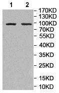 Western blot - Anti-GBA2 antibody (AB205064), expandable thumbnail