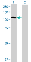 Western blot - Anti-GBA2 antibody (AB69366)