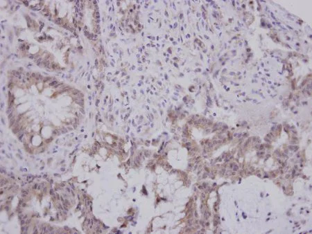 Immunohistochemistry (Formalin/PFA-fixed paraffin-embedded sections) - Anti-GBA3 antibody (AB154897)