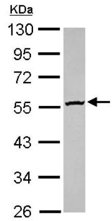 Western blot - Anti-GBA3 antibody (AB154897)