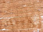 Immunohistochemistry (Formalin/PFA-fixed paraffin-embedded sections) - Anti-GBAS antibody (AB153833), expandable thumbnail
