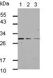 Western blot - Anti-GBAS antibody (AB153833), expandable thumbnail