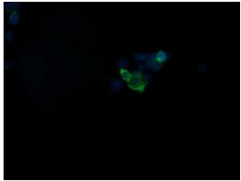 Immunocytochemistry/ Immunofluorescence - Anti-GBAS antibody [OTI1B8] (ab139357), expandable thumbnail