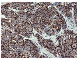 Immunohistochemistry (Formalin/PFA-fixed paraffin-embedded sections) - Anti-GBAS antibody [OTI1B8] (ab139357), expandable thumbnail