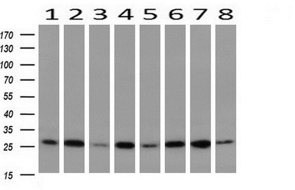 Western blot - Anti-GBAS antibody [OTI1B8] (AB139357), expandable thumbnail