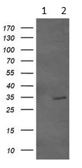 Western blot - Anti-GBAS antibody [OTI1B8] (AB139357)