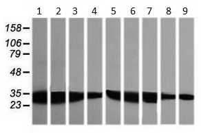 Western blot - Anti-GBAS antibody [OTI1B8] (AB139357), expandable thumbnail