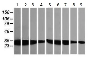 Western blot - Anti-GBAS antibody [OTI1B8] (AB139357)