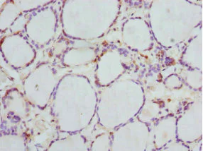 Immunohistochemistry (Formalin/PFA-fixed paraffin-embedded sections) - Anti-GBE1 antibody (AB223799)