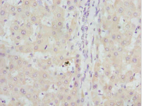 Immunohistochemistry (Formalin/PFA-fixed paraffin-embedded sections) - Anti-GBE1 antibody (AB223799)