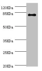 Western blot - Anti-GBE1 antibody (AB223799)
