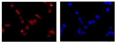 Immunocytochemistry/ Immunofluorescence - Anti-Gbeta5 antibody [EPR14778] (AB185206)