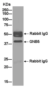 Immunoprecipitation - Anti-Gbeta5 antibody [EPR14778] - BSA and Azide free (AB250806)