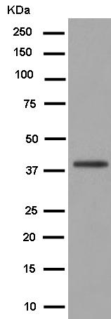 Western blot - Anti-Gbeta5 antibody [EPR14779(B)] - BSA and Azide free (AB250813), expandable thumbnail