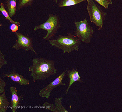 Immunocytochemistry/ Immunofluorescence - Anti-GBF1 antibody (AB86071)