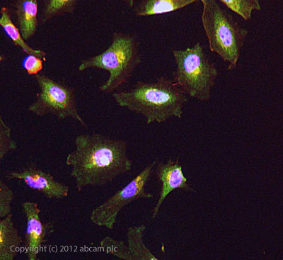 Immunocytochemistry/ Immunofluorescence - Anti-GBF1 antibody (AB86071)