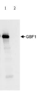 Immunoprecipitation - Anti-GBF1 antibody (AB86071)