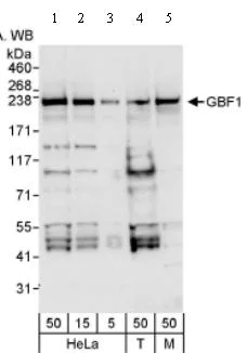 Western blot - Anti-GBF1 antibody (AB86071)