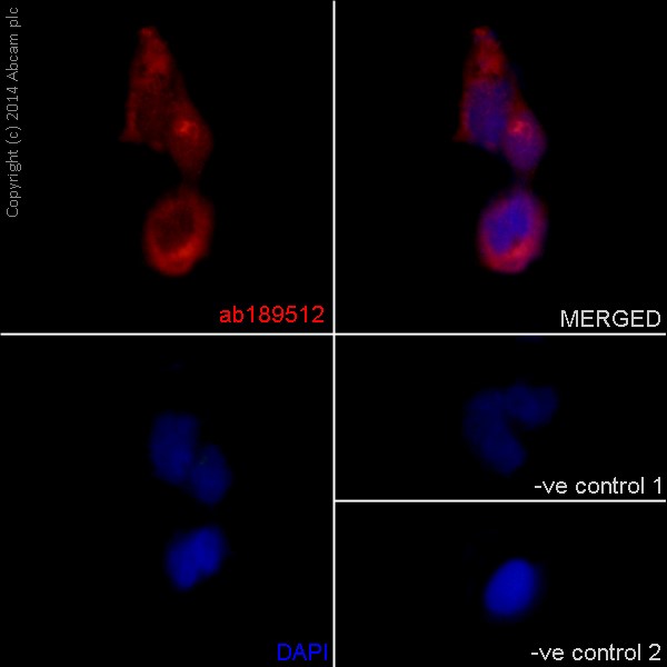 Immunocytochemistry/ Immunofluorescence - Anti-GBF1 antibody [EPR14889] - C-terminal (ab189512), expandable thumbnail