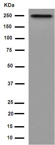 Western blot - Anti-GBF1 antibody [EPR14889] - C-terminal (AB189512), expandable thumbnail