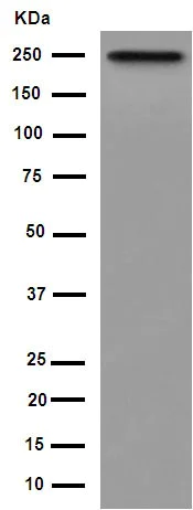 Western blot - Anti-GBF1 antibody [EPR14889] - C-terminal (AB189512)