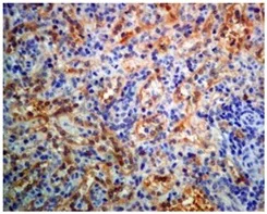 Immunohistochemistry (Formalin/PFA-fixed paraffin-embedded sections) - Anti-GBP1 antibody [EPR8285] (AB131255)