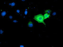 Immunocytochemistry/ Immunofluorescence - Anti-GBP1 antibody [OTI1B2] (AB119236)