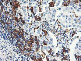 Immunohistochemistry (Formalin/PFA-fixed paraffin-embedded sections) - Anti-GBP1 antibody [OTI1B2] (AB119236)