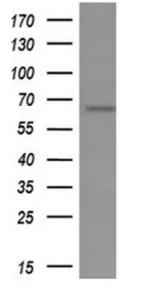 Western blot - Anti-GBP1 antibody [OTI1B2] (AB119236)