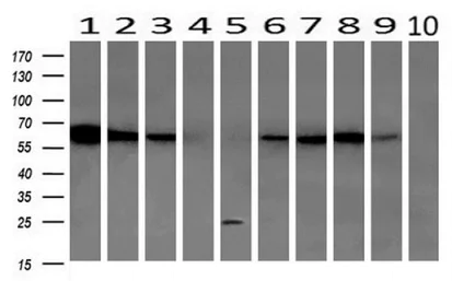 Western blot - Anti-GBP1 antibody [OTI1B2] (AB119236)