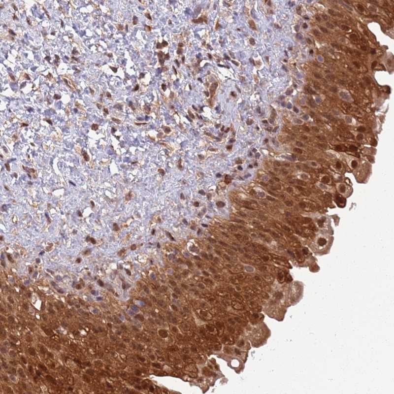 Immunohistochemistry (Formalin/PFA-fixed paraffin-embedded sections) - Anti-GBP2 antibody (AB247040)