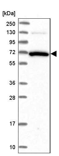 Western blot - Anti-GBP2 antibody (AB247040)
