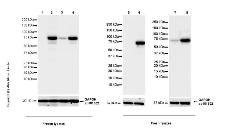 Western blot - Anti-GBP3 antibody [EPR30342-524] (AB326333)