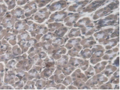 Immunohistochemistry (Formalin/PFA-fixed paraffin-embedded sections) - Anti-GBP4 antibody (AB232689)