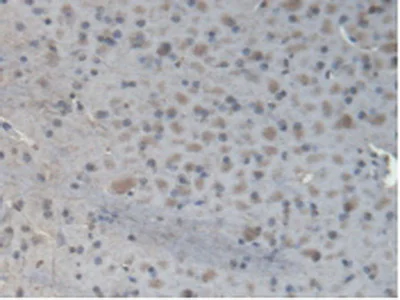 Immunohistochemistry (Formalin/PFA-fixed paraffin-embedded sections) - Anti-GBP4 antibody (AB232689)