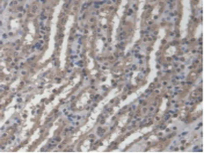 Immunohistochemistry (Formalin/PFA-fixed paraffin-embedded sections) - Anti-GBP4 antibody (AB232689)