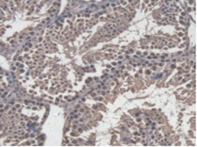 Immunohistochemistry (Formalin/PFA-fixed paraffin-embedded sections) - Anti-GBP4 antibody (AB232689)