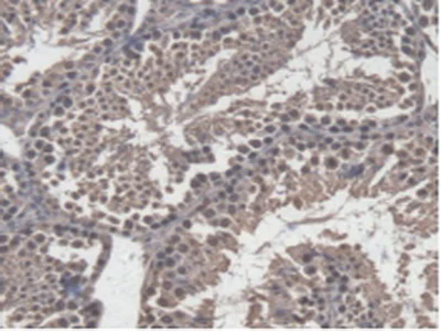 Immunohistochemistry (Formalin/PFA-fixed paraffin-embedded sections) - Anti-GBP4 antibody (AB232689)