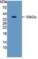 Western blot - Anti-GBP4 antibody (AB232689)