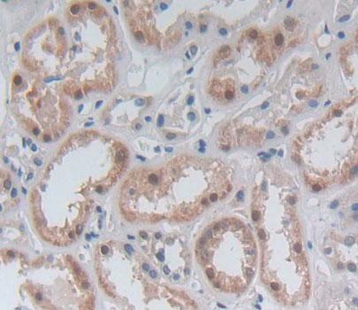 Immunohistochemistry (Formalin/PFA-fixed paraffin-embedded sections) - Anti-GBP4 antibody (AB232693), expandable thumbnail