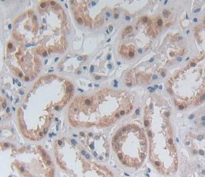 Immunohistochemistry (Formalin/PFA-fixed paraffin-embedded sections) - Anti-GBP4 antibody (AB232693)