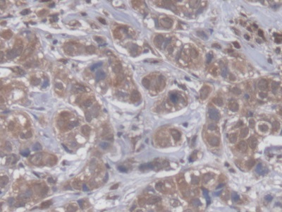 Immunohistochemistry (Formalin/PFA-fixed paraffin-embedded sections) - Anti-GBP4 antibody (AB232693), expandable thumbnail