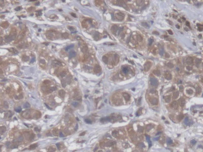 Immunohistochemistry (Formalin/PFA-fixed paraffin-embedded sections) - Anti-GBP4 antibody (AB232693)