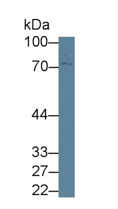 Western blot - Anti-GBP4 antibody (AB232693), expandable thumbnail