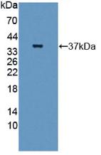 Western blot - Anti-GBP4 antibody (AB232693), expandable thumbnail
