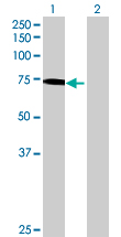 Western blot - Anti-GBP4 antibody (AB70058), expandable thumbnail
