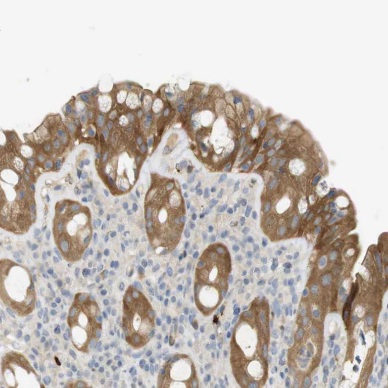 Immunohistochemistry (Formalin/PFA-fixed paraffin-embedded sections) - Anti-GBP5 antibody (AB244422)